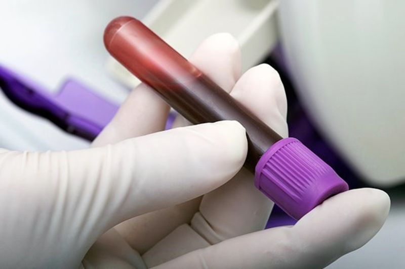 Five Human Cases Of Rabies Confirmed In Sa Since December '17 1