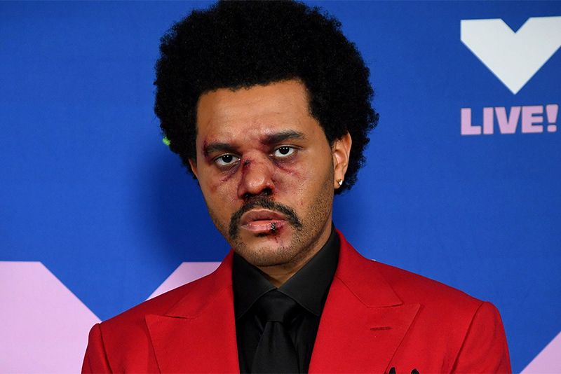 The Weeknd Sparks Concern After Bruised Face At MTV Awards 1