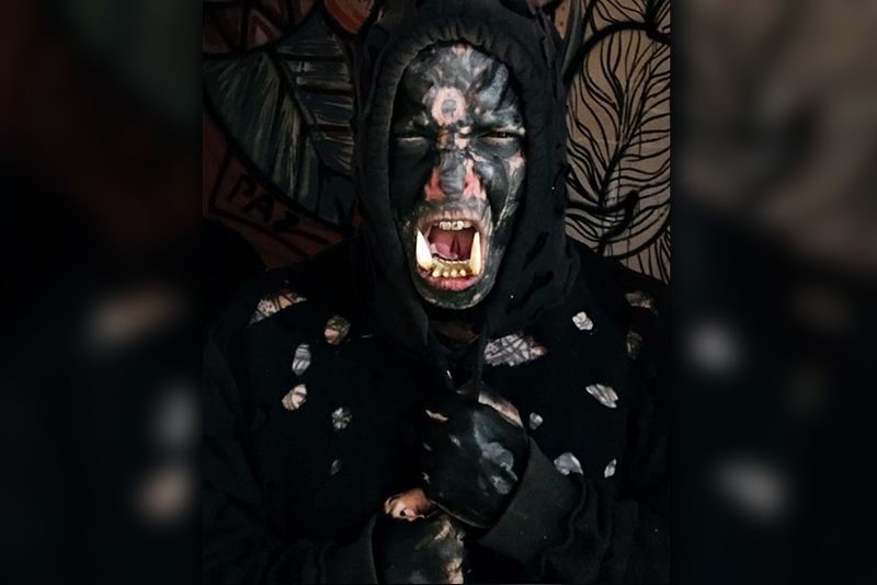 Man Obsessed With Body Modifications Gets Customised Tusks For Teeth 1