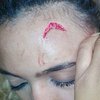 Immunity For Grace Mugabe's Assault On Gabriella Engels To Be Challenged By Afriforum 5